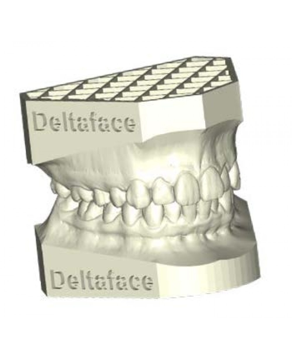 Deltaface 3D Orthodontic Design Software Arch Base for dental model creation CAD Design