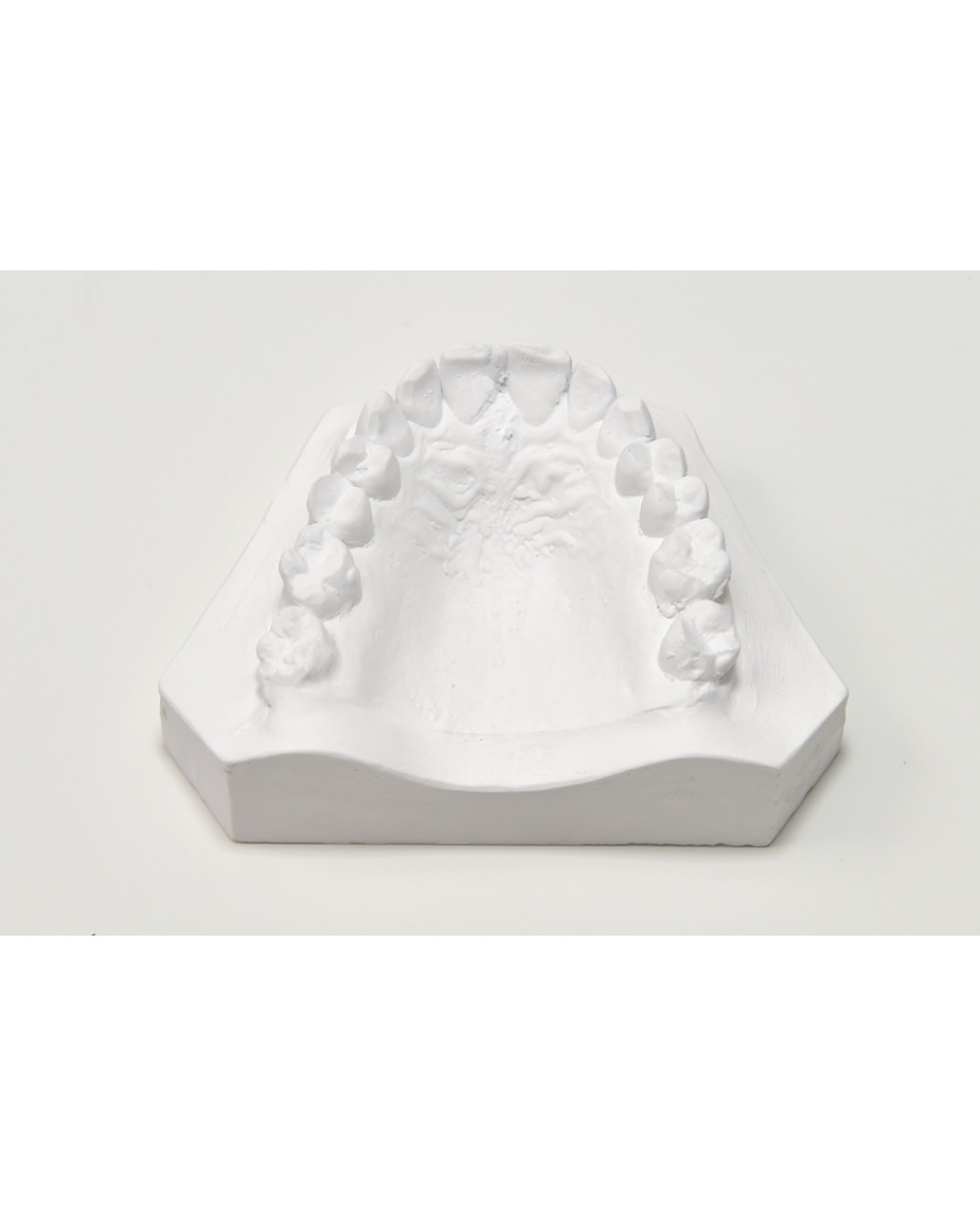 thumbnail image 2 of BESQUAL Diamond Disc Serrated 45mm X 0.17mm – For Plaster & Die Stone, Dental Lab 2 of 5