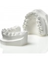25kg Zhermack Elite Ortho - White stone for orthodontic models