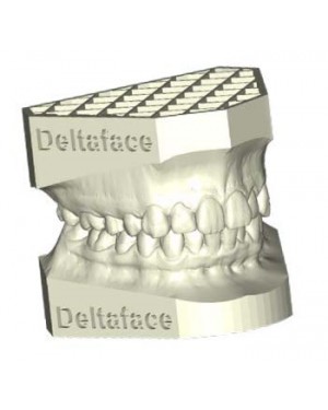 Deltaface 3D Orthodontic Design Software - Arch Base for dental model creation